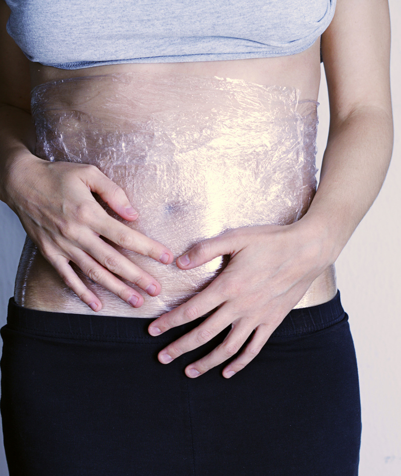 Full Marks for Stretch Marks | Getty Images Photo by luckyj1