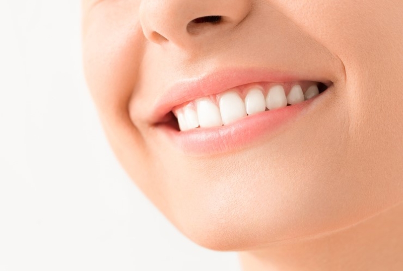 Blanqueador dental | REDPIXEL.PL/Shutterstock