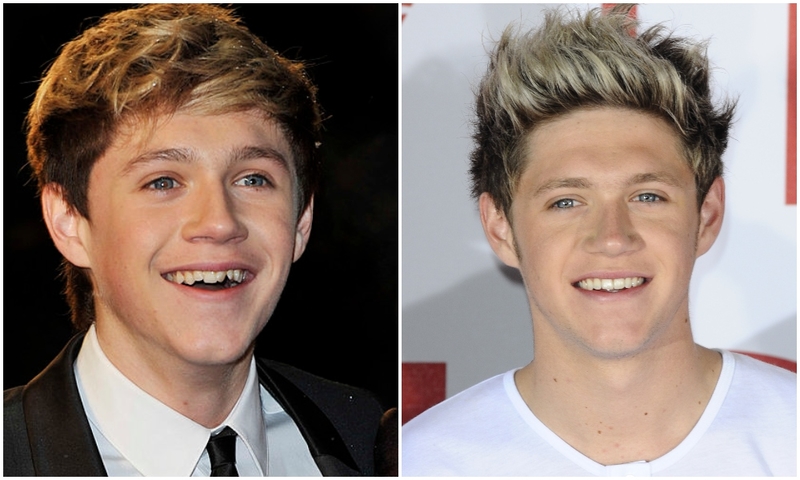 Niall Horan | Getty Images Photo by Gareth Cattermole & Shutterstock