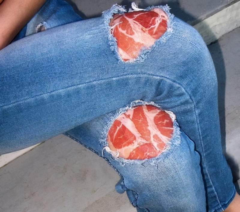 Parches de carne para las rodillas | Imgur.com/fWn7aw7